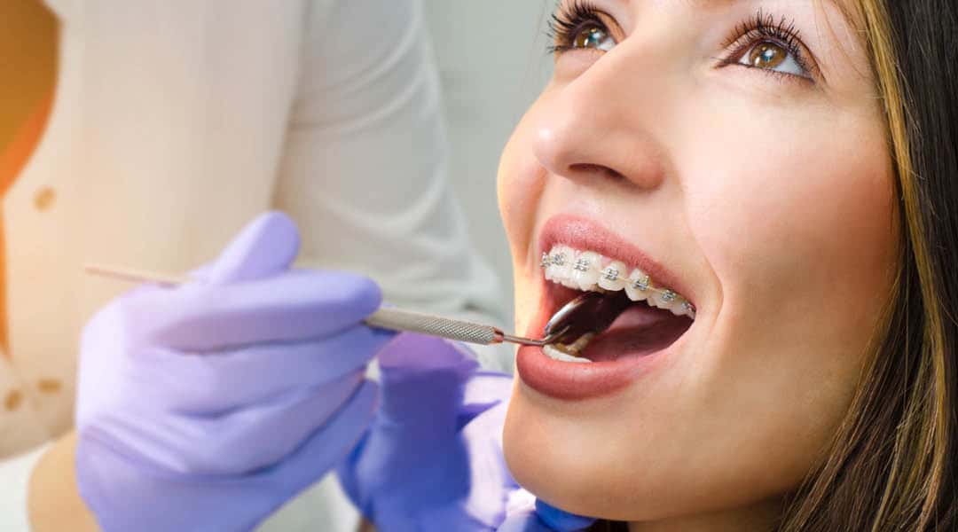 Orthodontic services. A lady has braces fitted.
