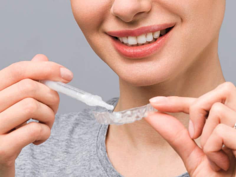 Orthodontic services. A lady holding a teeth whitening kit.